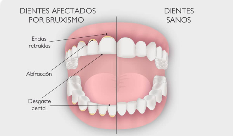 Posibles hábitos nocivos: