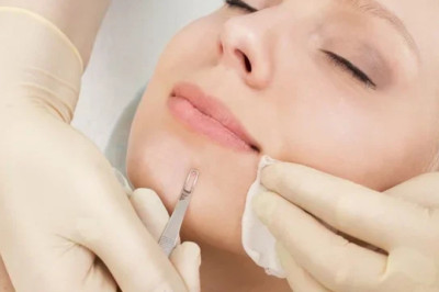 Procedimientos en limpieza profunda