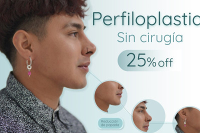 Perfiloplastia