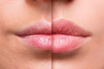 ¿Cansada de la misma apariencia de tus labios?