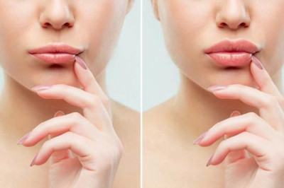 ¿Quieres tener más volumen en tus labios?