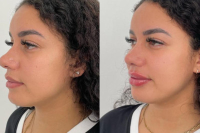 Tarjetas de regalo 2x1 en procedimientos seleccionados