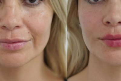 Aumenta el volumen de tus labios