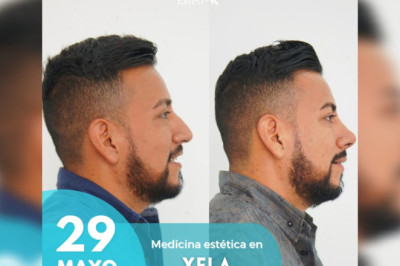 Medicina estética en Xela este 29 de mayo.