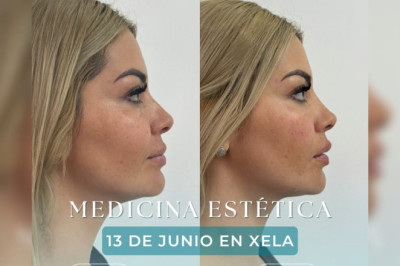Medicina Estética siempre cerca de ti.