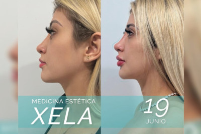 Medicina Estética XELA