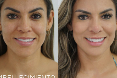 Medicina Estética en Cobán 27 de Junio