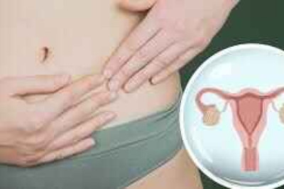 🌸 Vidafemme: orientación y cuidado para el síndrome de ovario poliquístico